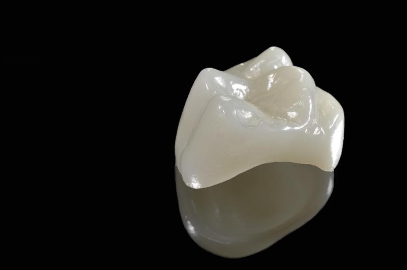 Porcelain Crowns Jamestown, TN